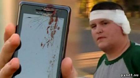 Смартфон Motorola Droid 2 чуть не оторвал ухо своему хозяину